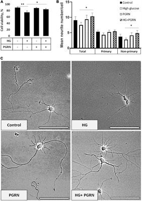 Progranulin Preserves Autophagy Flux and Mitochondrial Function in Rat Cortical Neurons Under High Glucose Stress